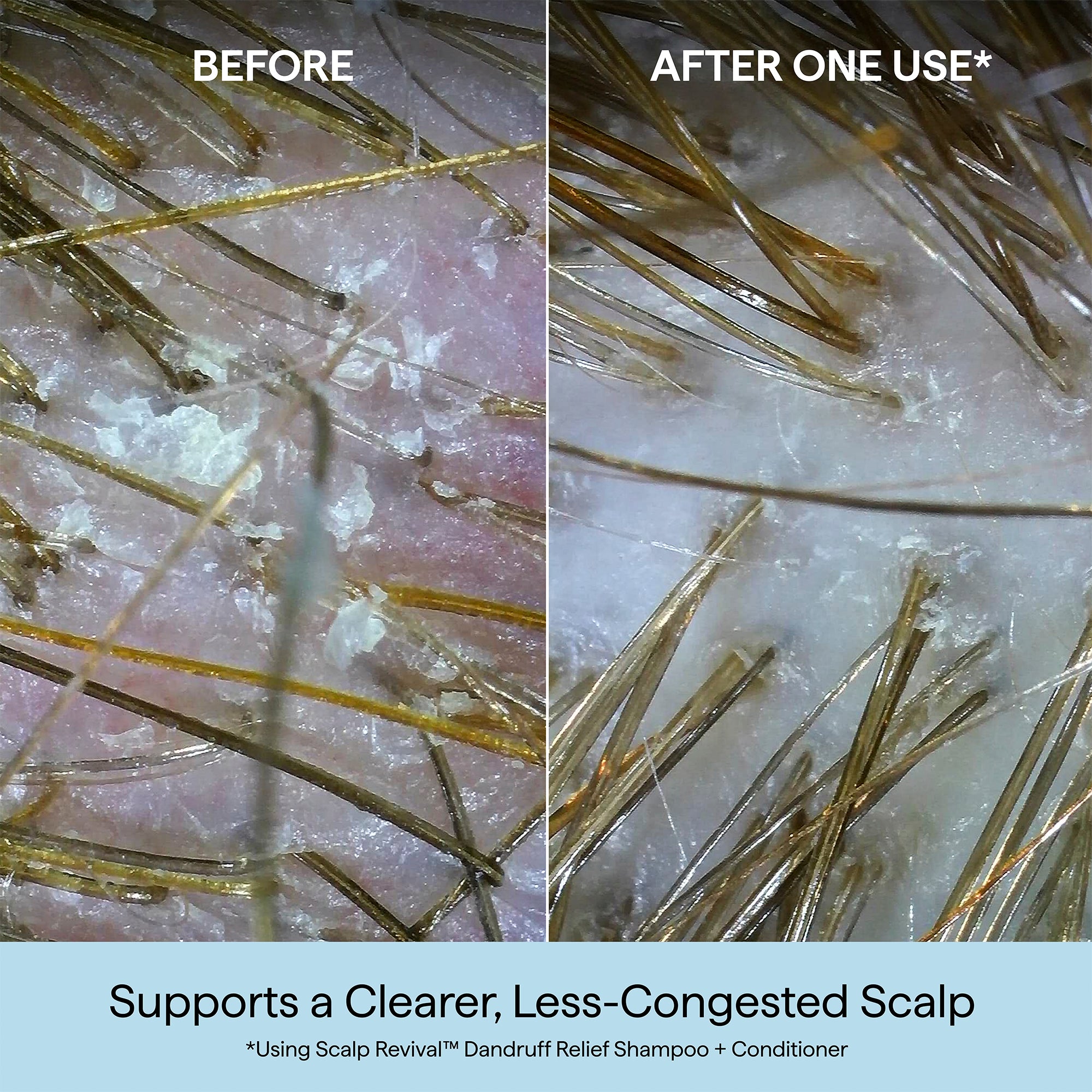 Scalp Revival™ Dandruff Relief Conditioner with Charcoal + 1.8% Salicylic Acid - Briogeo